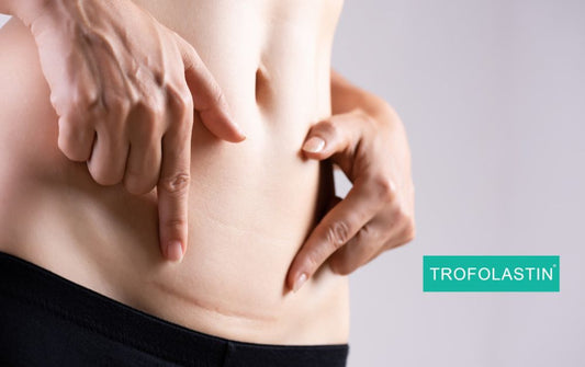 Trofolastin cicatrices: Qué es, cómo funciona y qué resultados ofrece de verdad