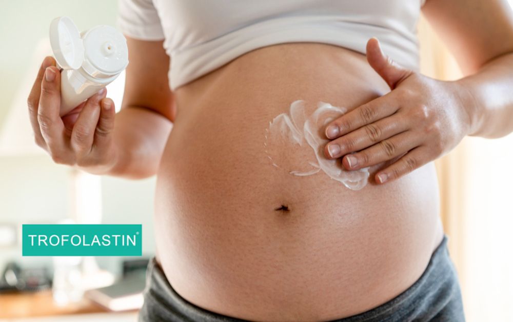 Trofolastin Antiestrías: Guía completa para embarazo y postparto